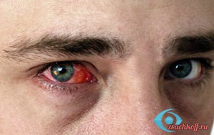 Elérhető a szem betegségeiről
