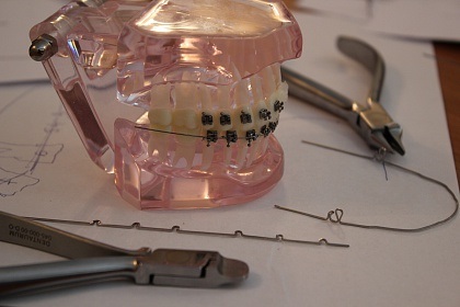 Arc - ca element principal în mecanismul de tratament ortodontic (curs de 2 zile)