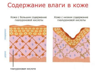Acid hialuronic pentru uzul feței, contraindicații, utilizare în casă