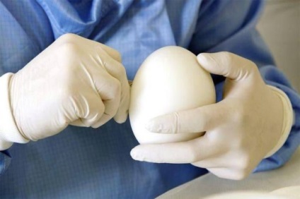 Implanturile de sân - Ce trebuie să fiți atenți la mărirea sânilor
