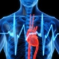 Infarctul miocardic și tratamentul acestuia, inclusiv cu ajutorul lipitorilor - bisturiu - medical