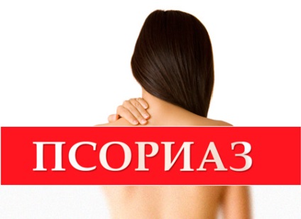 Tratamentul psoriazisului și eczemelor în sanatorii din Poltava-Crimeea, Saki, Rusia