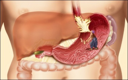 Tratamentul bolilor tractului gastro-intestinal în sanatoriile din Belarus, sanatorii din Belarus