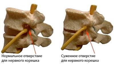 Lyumbalizatsiya и sacralization