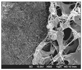 Matrix este un material inovator pe bază de colagen - sistemul de implant dentar biotehnic dentar