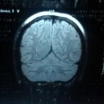 Martha din creier, ajutor, te rog - o întrebare pentru neuropatolog - 03 online