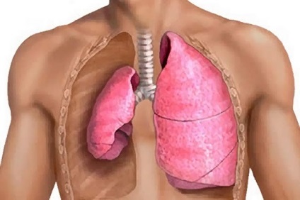 Pneumotoraxul cauzei, simptomelor și tratamentului ușor - Info pentru sănătate