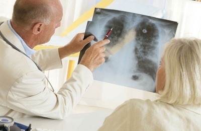 Are fluorografia cancerului pulmonar și cum arată tumoarea în imagine