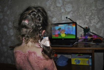 Egy ötéves kislány tűzbe kezdett tündér Winx lett Cheboksaréban június 2., 2106, hírek