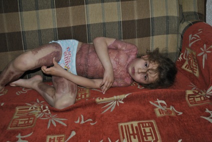Egy ötéves kislány tűzbe kezdett tündér Winx lett Cheboksaréban június 2., 2106, hírek