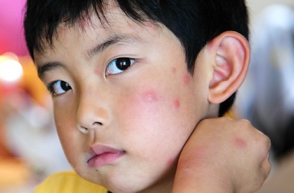 Spuneți copilului care este un astfel de țânțar și cum să se ocupe de el