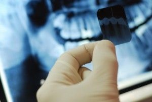 X-ray a dintelui în timpul sarcinii pot face o fotografie