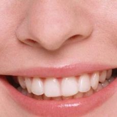 Cât timp puteți mânca după o prelungire a dinților?