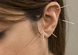 Puncte pe urechile responsabile de organele punctelor de acupunctura