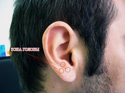 Puncte pe urechile responsabile de organele punctelor de acupunctura