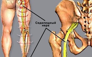 Punctele de ieșire ale nervului sciatic