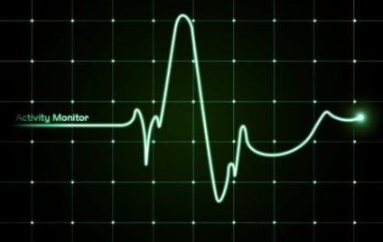 A szívdobogás tachycardiát okoz