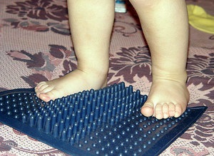 Picior Valgus la copii, cauze, simptome, diagnostic și tratament