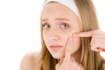 Tipuri de acnee pe fata de stadiul de dezvoltare a acneei si clasificarea lor