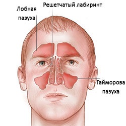 Inflamația simptomelor sinusurilor frontale și tratamentul cu medicamentele folclorice