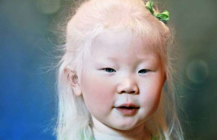 25 Fapte curioase și incredibile despre oameni - albino, naibii