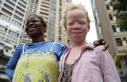 25 Fapte curioase și incredibile despre oameni - albino, naibii