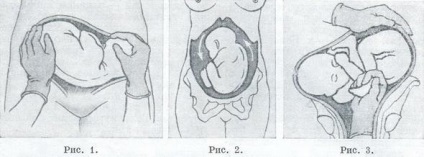 Stadiul de obstetrică