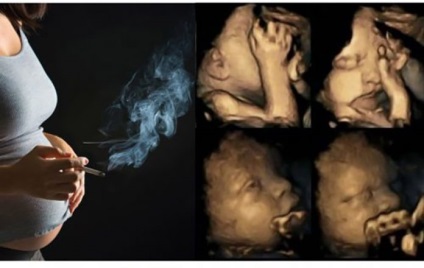Femeile gravide continuă să fumeze țigări