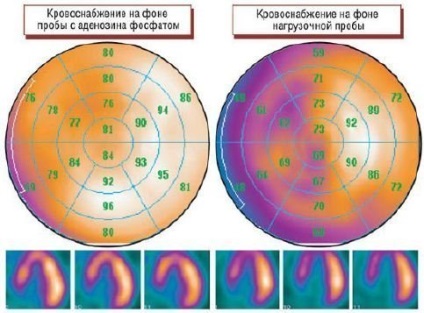 Diagnosticul ibs în grupurile de pacienți selectați