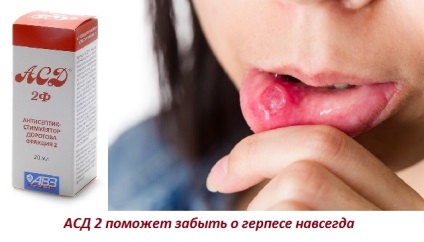 Fraction asd 2 cerere pentru herpes