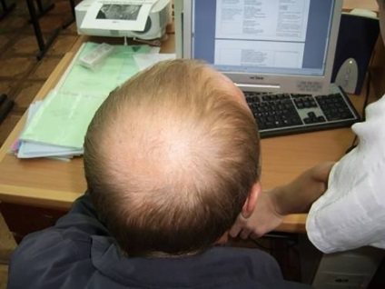 Alopecia hormonala sunt cauzele, tratamentul si simptomele, centrul este k33