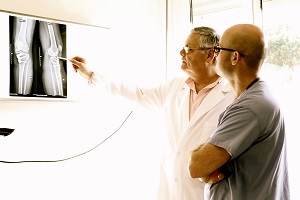 Biotehnologia inovatoare pentru restaurarea articulațiilor mari, o rețea de doctori saloane ortopedice