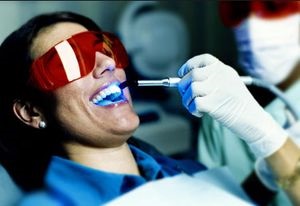 A lézeres fogak tisztítása ár ellenjavallt
