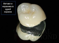 Tratamentul bolii parodontale (metode moderne) - cum să tratați eficient parodontita