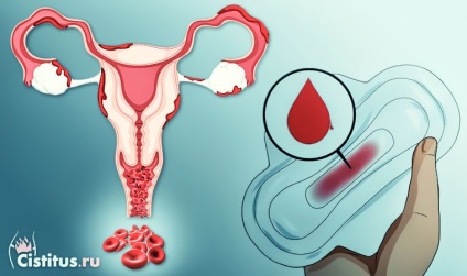 Sângerarea uterină cu cauze și tratament climacteric