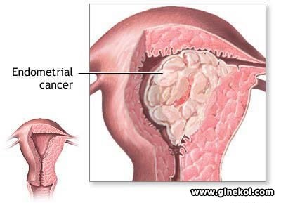 Menstruație, ginecologie și obstetrică