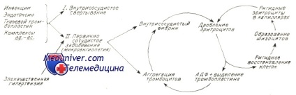 Anemie hemolitică microangiopatică - istoric al studiului, cauze