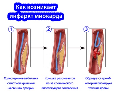 Monochinkwe retard jelzések és használati utasítások, árak, analógok, vélemények