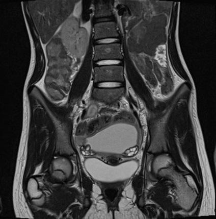 Mt de uter și ovare la prețurile de la Moscova și reduceri de noapte, în cazul în care pentru a face bucuria de col uterin și uterine appendages cu