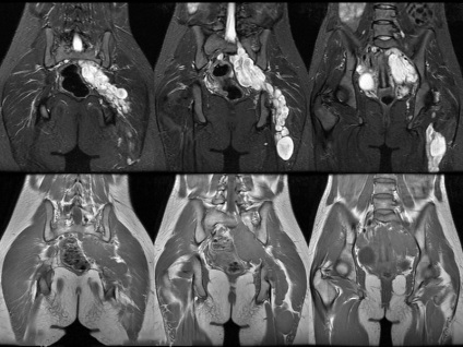 Mt de uter și ovare la prețurile de la Moscova și reduceri de noapte, în cazul în care pentru a face bucuria de col uterin și uterine appendages cu