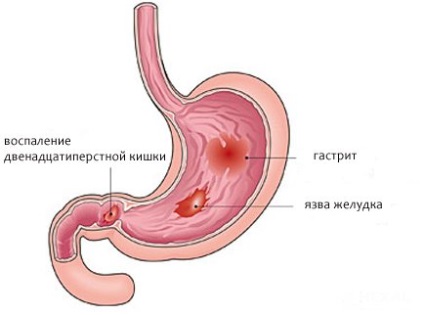 Mt indicatii si contraindicatii, coloanei vertebrale, articulatii, abdominale si cavitate