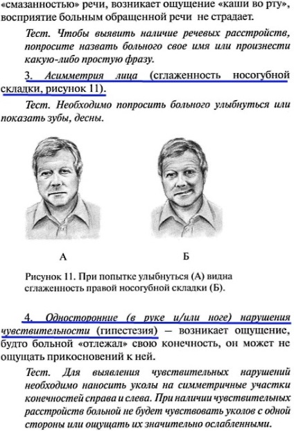 Încălcarea circulației cerebrale