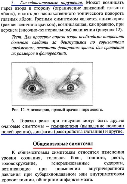 Încălcarea circulației cerebrale