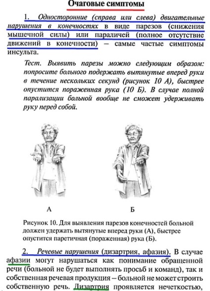 Încălcarea circulației cerebrale