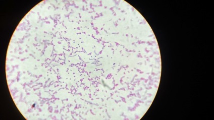 Colorarea bacteriilor pe gram