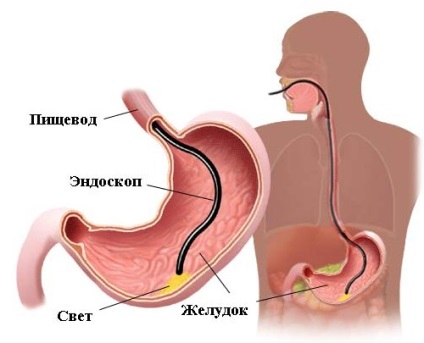 Tumor tünetek, kezelés és osztályozás