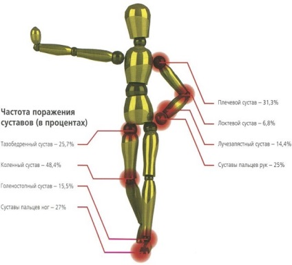 Osteo instrucțiuni complexe privind utilizarea medicamentului