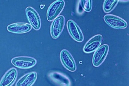 Paraziták az emberi test tünetei és kezelése