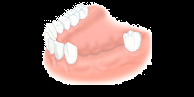 Pacienți - clinică dentară cu ferrostom g