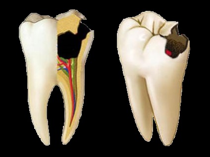 Pacienți - clinică dentară cu ferrostom g